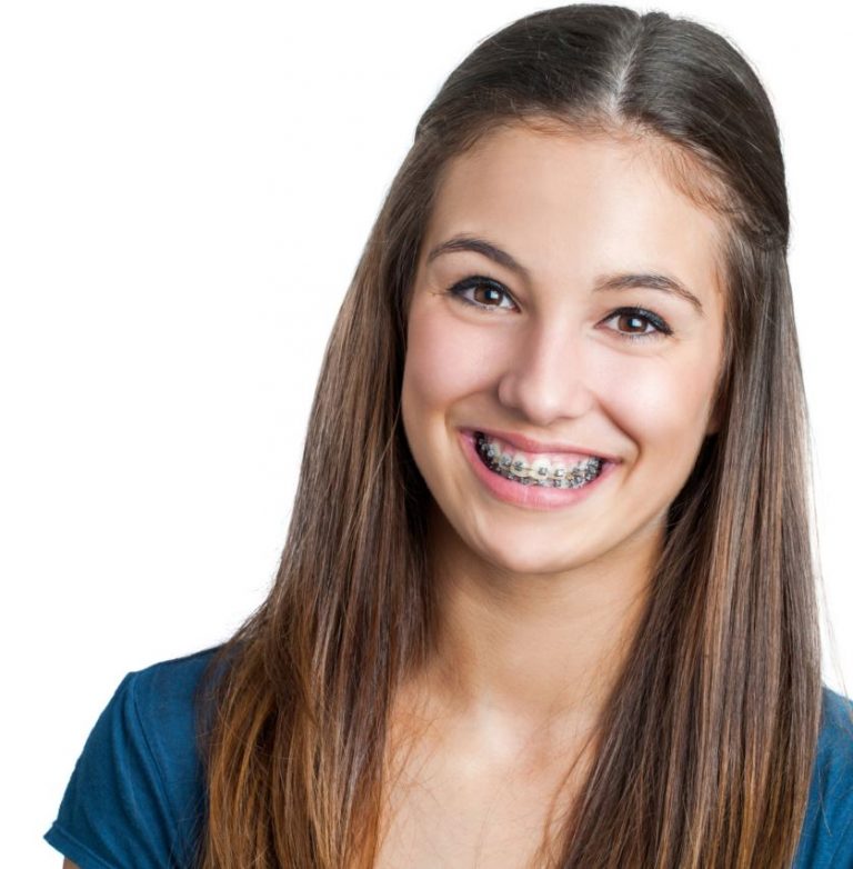 6 Tips for Going Back to School with Braces Thurman Orthodontics